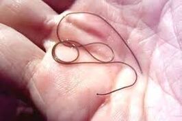 Parasite in the palm of your hand