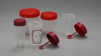 how to prepare for the test of parasites