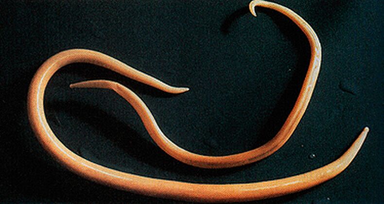 worm parasite from the human body